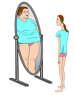 Ilustración de una mujer muy delgada frente a un espejo en el que se refleja obesa. 